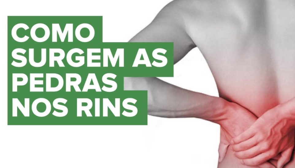 Como Prevenir Pedra Nos Rins Cálculos Renais VEJA