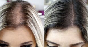 8a54e com tratar queda de cabelo em casa