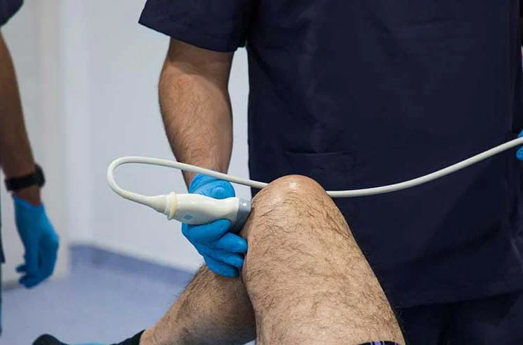 Banda iliotibial ou joelho do corredor, uma lesão muito frequente entre os corredores.