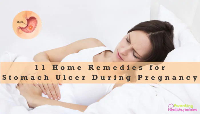 Úlcera de estômago durante a gravidez: 11 remédios caseiros eficazes